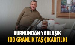Burnundan yaklaşık 100 gramlık taş çıkartıldı