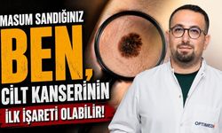 Masum sandığınız ben, cilt kanserinin ilk işareti olabilir