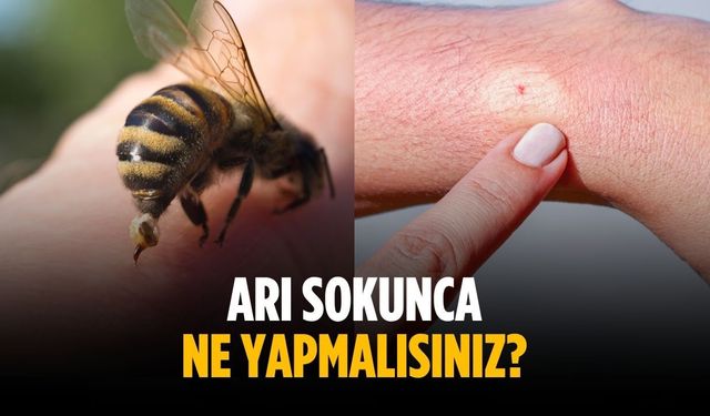 Arı sokunca ne yapmalısınız?