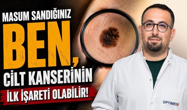 Masum sandığınız ben, cilt kanserinin ilk işareti olabilir