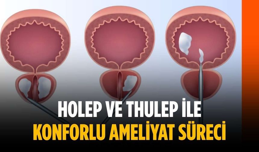 HoLEP ve ThuLEP ile konforlu ameliyat süreci